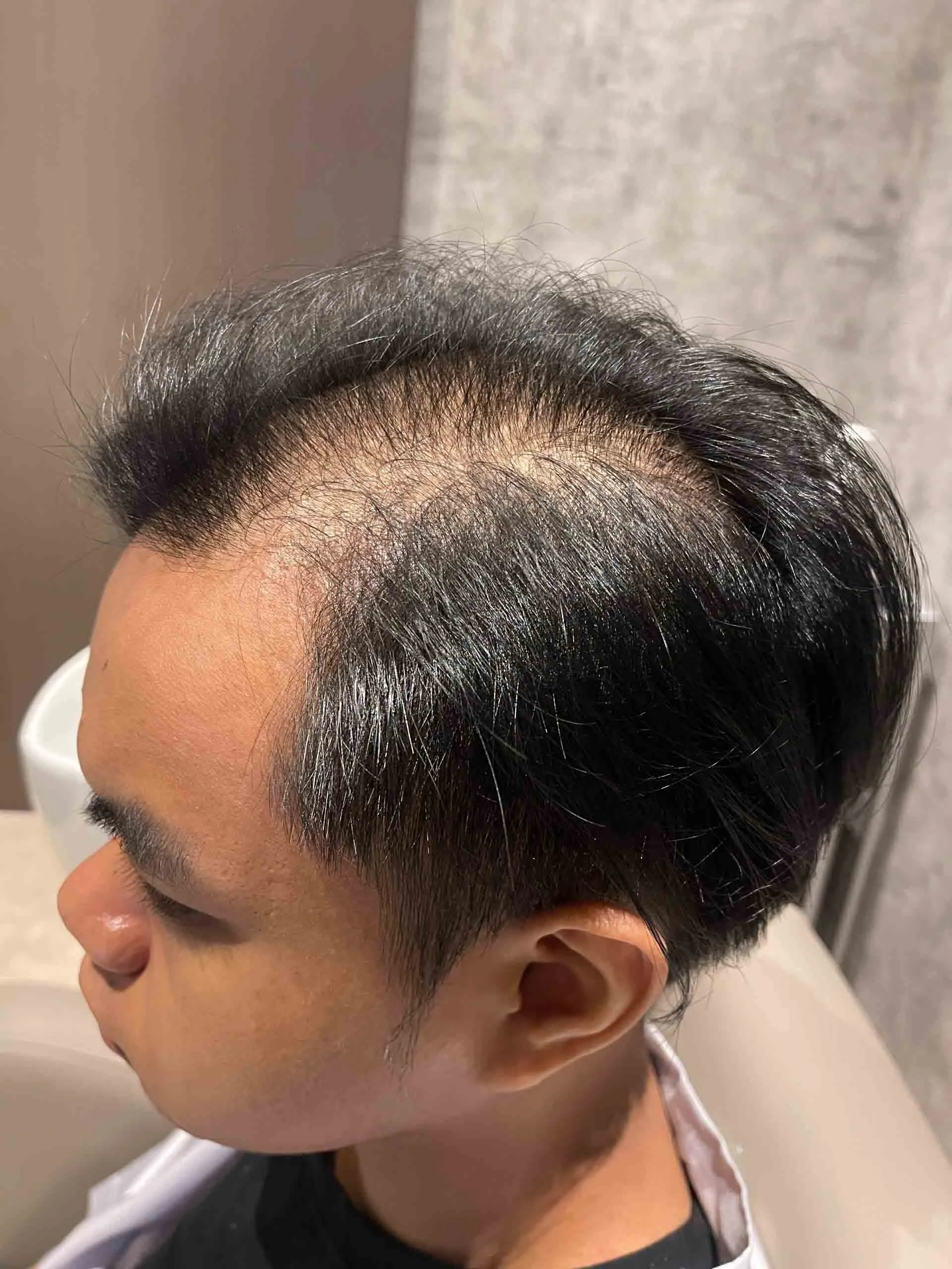 before-3
